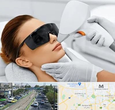 مرکز لیزر مو در جنوب تهران