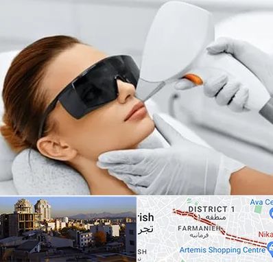 مرکز لیزر مو در فرمانیه