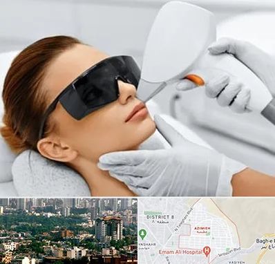 مرکز لیزر مو در عظیمیه کرج