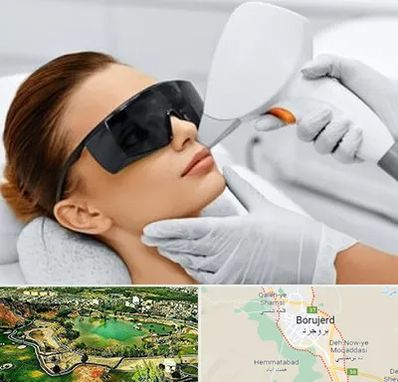 مرکز لیزر مو در بروجرد