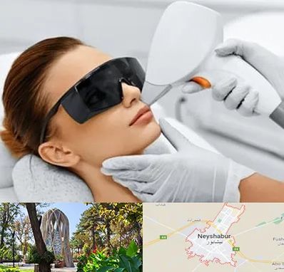 مرکز لیزر مو در نیشابور