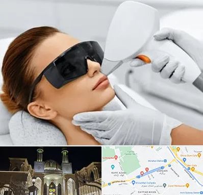 مرکز لیزر مو در زرگری شیراز