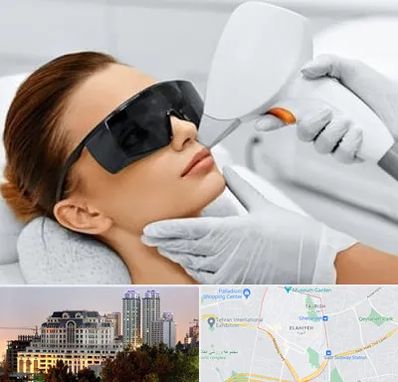 مرکز لیزر مو در فرشته