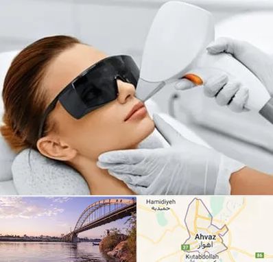 مرکز لیزر مو در اهواز