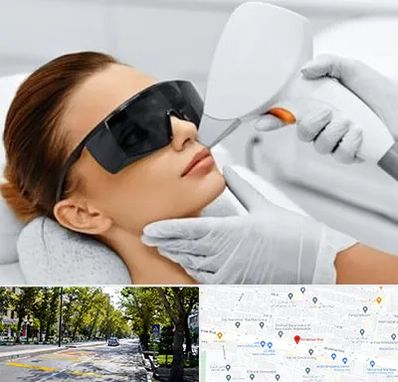 مرکز لیزر مو در میرداماد