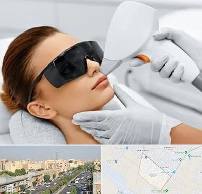 مرکز لیزر مو در کیانمهر کرج