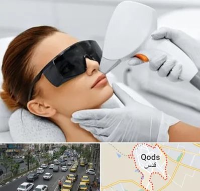 مرکز لیزر مو در شهر قدس