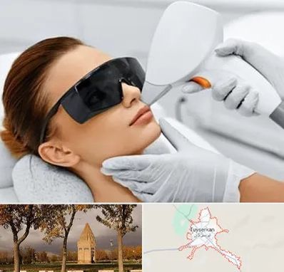 مرکز لیزر مو در تویسرکان