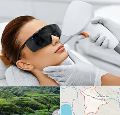 مرکز لیزر مو در گچساران