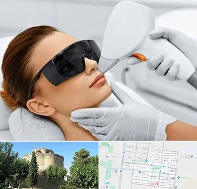 مرکز لیزر مو در مرداویج اصفهان