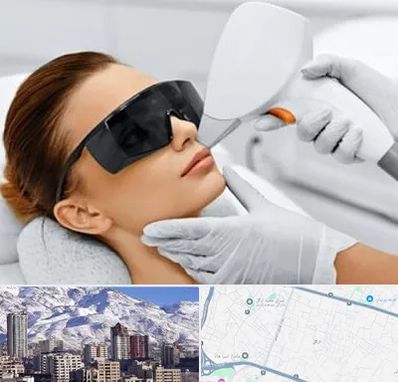 مرکز لیزر مو در ازگل