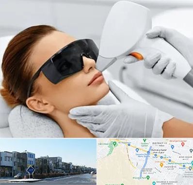 مرکز لیزر مو در شریعتی مشهد