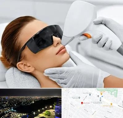 مرکز لیزر مو در هفت تیر مشهد