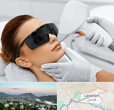 مرکز لیزر مو در لواسان