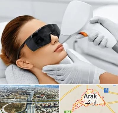 مرکز لیزر مو در اراک