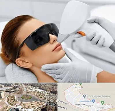 مرکز لیزر مو در پرند