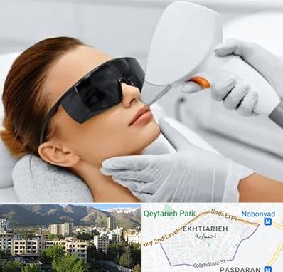 مرکز لیزر مو در اختیاریه