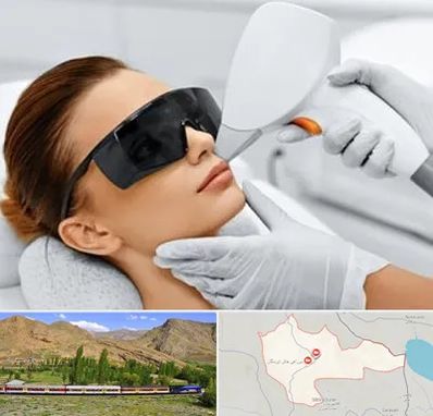 مرکز لیزر مو در خاش