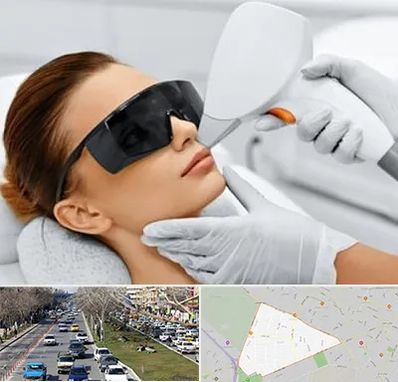 مرکز لیزر مو در احمدآباد مشهد