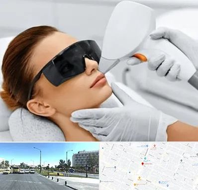 مرکز لیزر مو در بلوار کلاهدوز مشهد