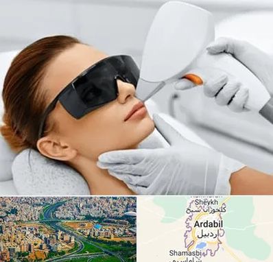 مرکز لیزر مو در اردبیل