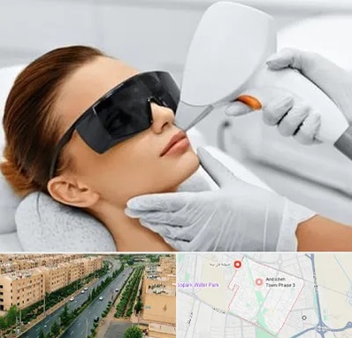 مرکز لیزر مو در فاز سه اندیشه