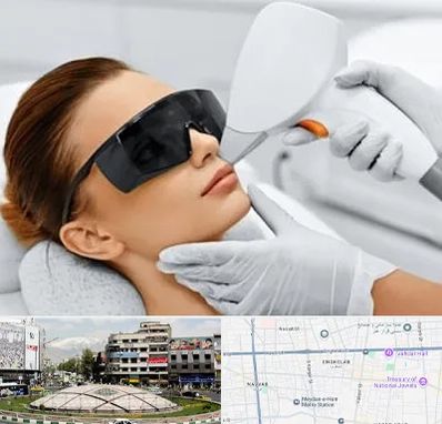 مرکز لیزر مو در مرکز تهران