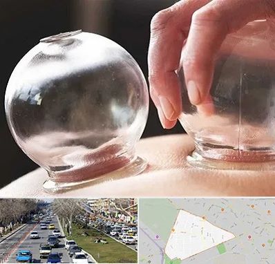 مرکز حجامت در احمدآباد مشهد