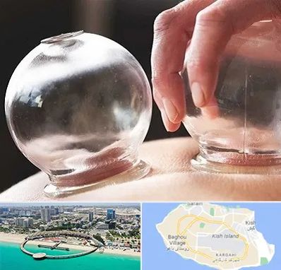 مرکز حجامت در کیش