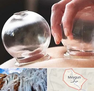 مرکز حجامت در میگون