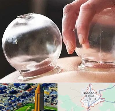 مرکز حجامت در گنبد کاووس