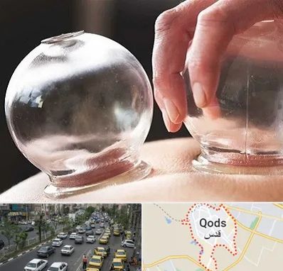 مرکز حجامت در شهر قدس