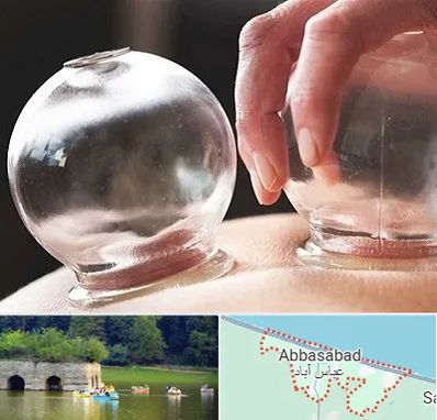 مرکز حجامت در عباس آباد