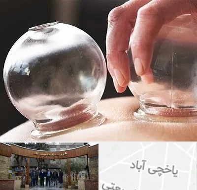 مرکز حجامت در یاخچی آباد
