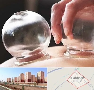 مرکز حجامت در پردیسان قم