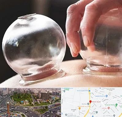 مرکز حجامت در سبلان