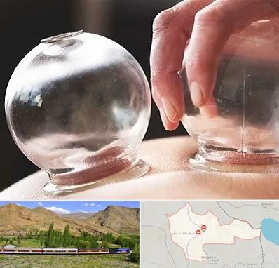 مرکز حجامت در خاش