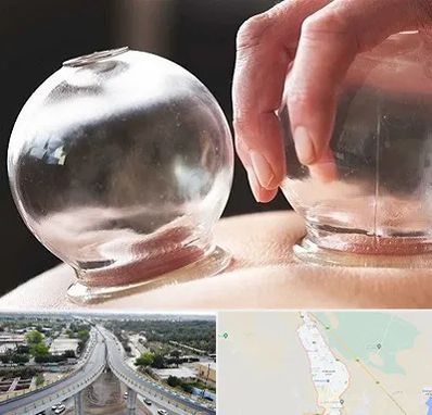 مرکز حجامت در اندیمشک