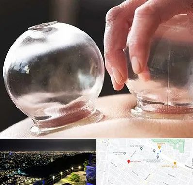 مرکز حجامت در هفت تیر مشهد