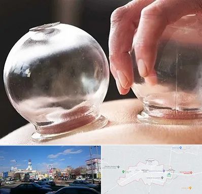 مرکز حجامت در ماهدشت کرج