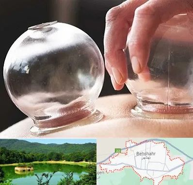 مرکز حجامت در بهشهر