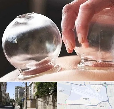مرکز حجامت در مهرآباد