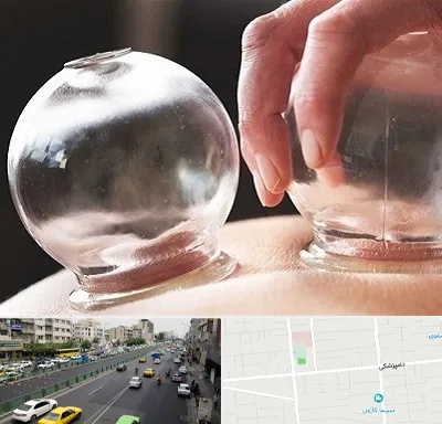 مرکز حجامت در خیابان دامپزشکی