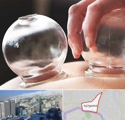 مرکز حجامت در محمودیه