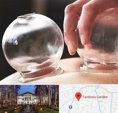 مرکز حجامت در باغ فردوس