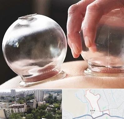 مرکز حجامت در اوین