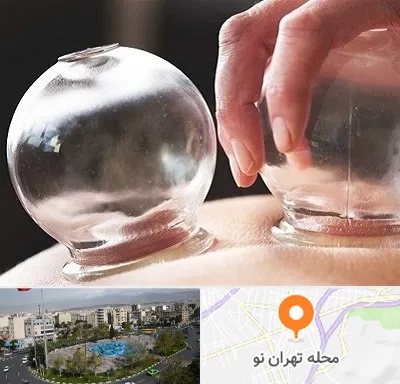 مرکز حجامت در تهران نو