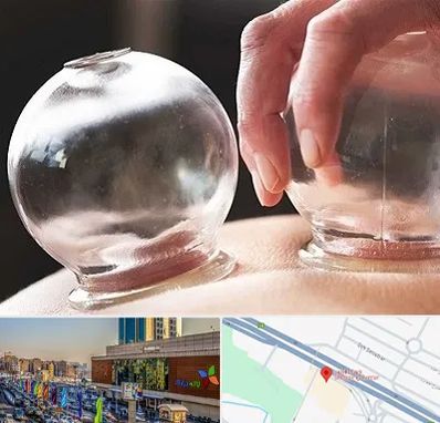 مرکز حجامت در لاله پارک تبریز