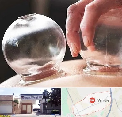 مرکز حجامت در وحیدیه شهریار