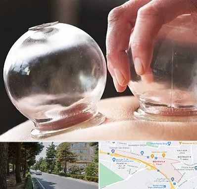 مرکز حجامت در مهرویلا کرج